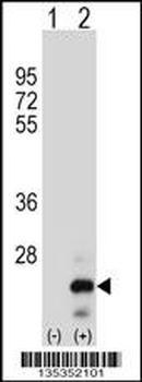 TNFSF18 Antibody (Center)