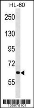 ANKHD1 Antibody (N-term)