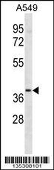 LTB4R2 Antibody (C-term)