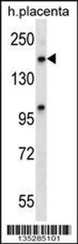 XPO5 Antibody (C-term)
