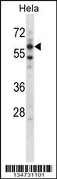 Mouse Adck5 Antibody (N-term)