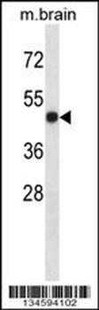 LTBR Antibody (N-term)