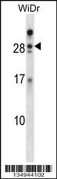 AZU1 Antibody (Center)