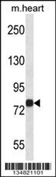 Mouse Map4k2 Antibody (Center)