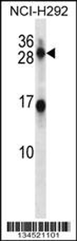 KLK14 Antibody (N-term)