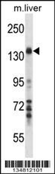 Mouse Map3k1 Antibody (C-term)