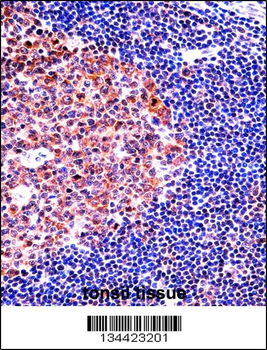 MCM4 Antibody (C-term)