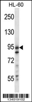USP20 Antibody (Center)