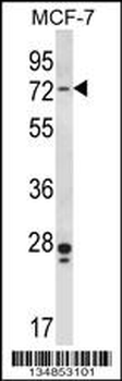Mouse Pak4 Antibody (Center)