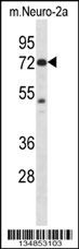 Mouse Pak4 Antibody (Center)