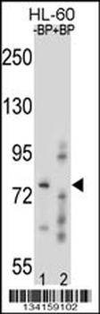 RNF40 Antibody (C-term)