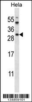AKT1S1 Antibody (C-term)