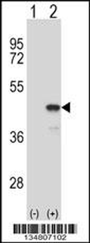 Mouse Map2k1 Antibody (C-term)