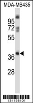 GPR15 Antibody (C-term)