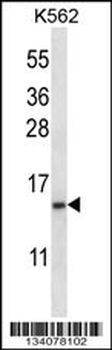 TNFRSF13C Antibody (N-term)