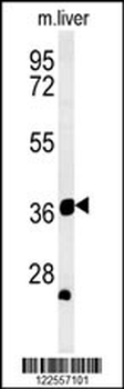TRAF1 Antibody (N-term)