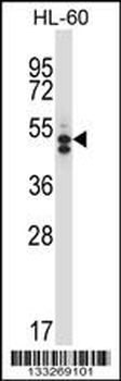 HDAC7 Antibody (C-term)