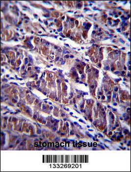 HDAC7 Antibody (C-term)