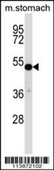 TFCP2L1 Antibody (Center)