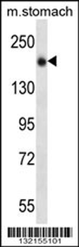 UNC13B Antibody (N-term)
