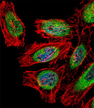 SP140 Antibody (Center)