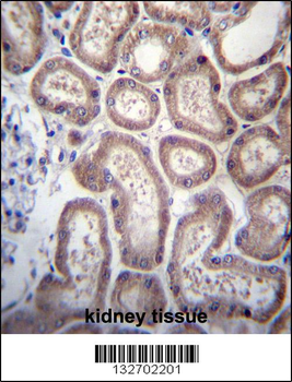 SP140 Antibody (Center)