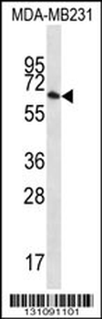 GBP1 Antibody (N-term)
