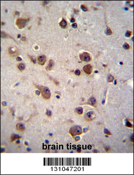 CHST6 Antibody (C-term)