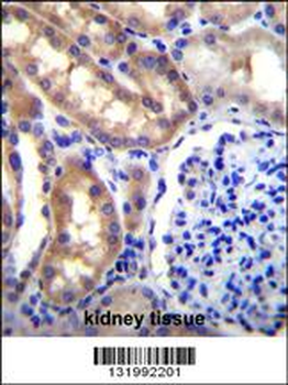SH2D4A Antibody (N-term)
