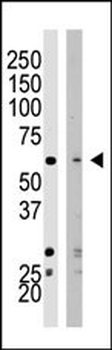 SET07 Antibody (N-term)