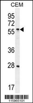 DLK Antibody