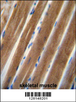 TNIP1 Antibody (C-term)