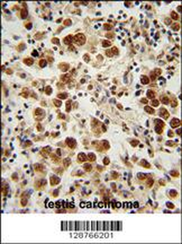 SOHLH1 Antibody (N-term)