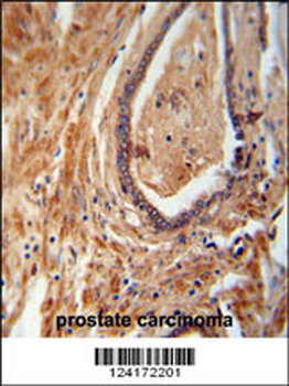 NDUFAF1 Antibody (C-term)