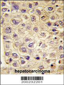 TYRO3 Antibody