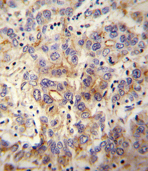 MET/HGFR Antibody
