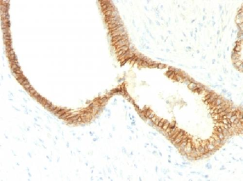 E-Cadherin / CD324 Antibody