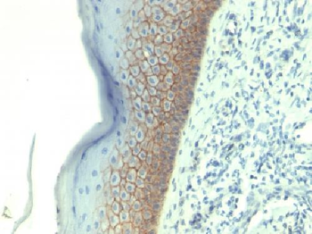 E-Cadherin / CD324 Antibody