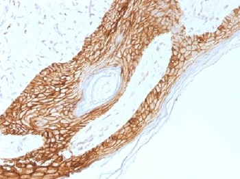 E-Cadherin / CD324 Antibody