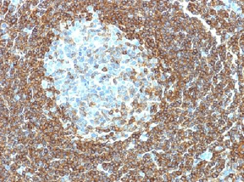 CD3e (T-Cell Marker) Antibody