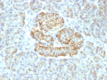 TNF-alpha (Tumor Necrosis Factor alpha) Antibody