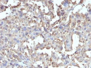 TNF-alpha (Tumor Necrosis Factor alpha) Antibody