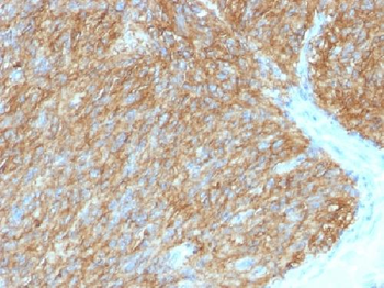 DOG-1 / TMEM16A Antibody