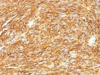DOG-1 / TMEM16A Antibody