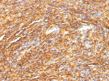 DOG-1 / TMEM16A Antibody