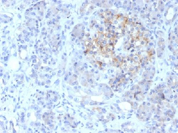 MRP1 / ABCC1 Antibody