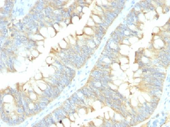 MRP1 / ABCC1 Antibody