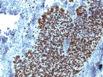 FOXA1 / HNF3A Antibody