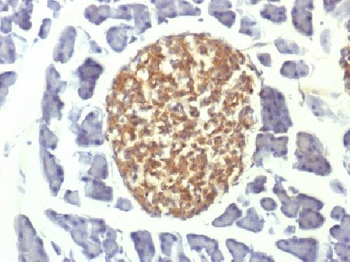 NSE gamma Antibody