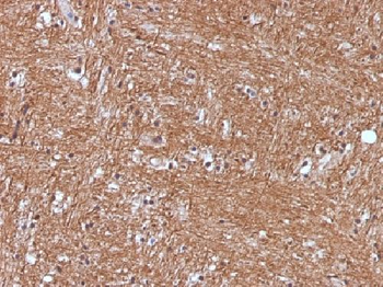 NSE gamma Antibody